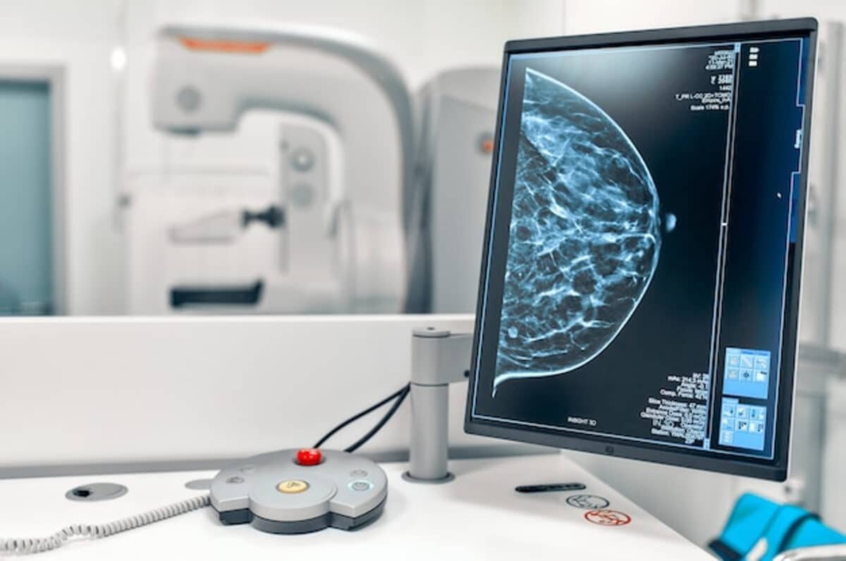 ¿Cuánto cuestan los exámenes para detectar el cáncer de mama en Caracas?