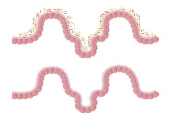 ¿Cómo el ejercicio físico modera la microbiota y potencia la salud cerebral?