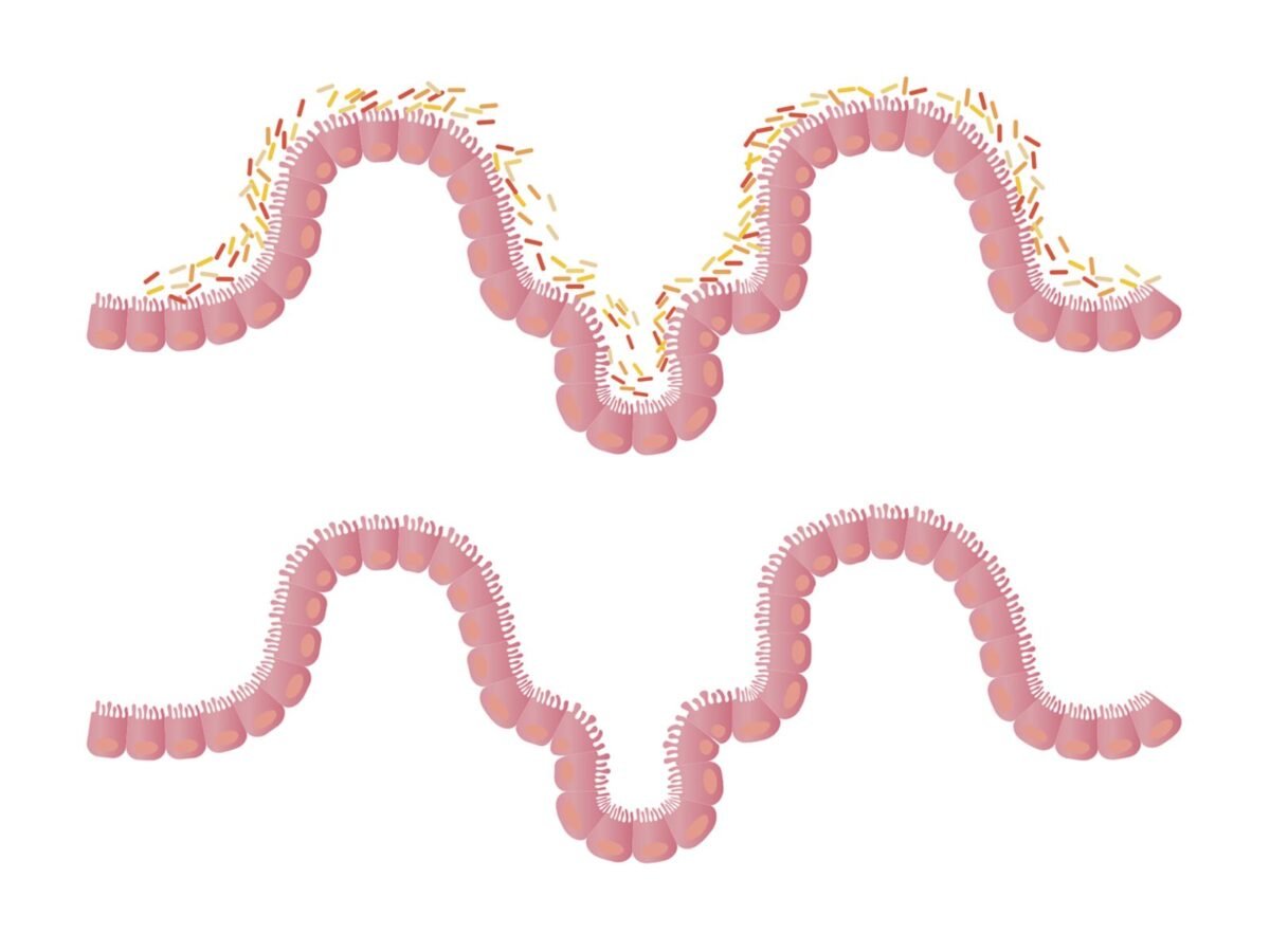 ¿Cómo el ejercicio físico modera la microbiota y potencia la salud cerebral?