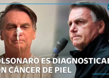 Diagnosticaron a Bolsonaro con cáncer de piel