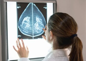 Estudio reveló tratamiento más efectivo para pacientes con cáncer de mama metastásico