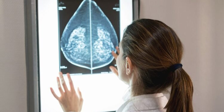 Estudio reveló tratamiento más efectivo para pacientes con cáncer de mama metastásico