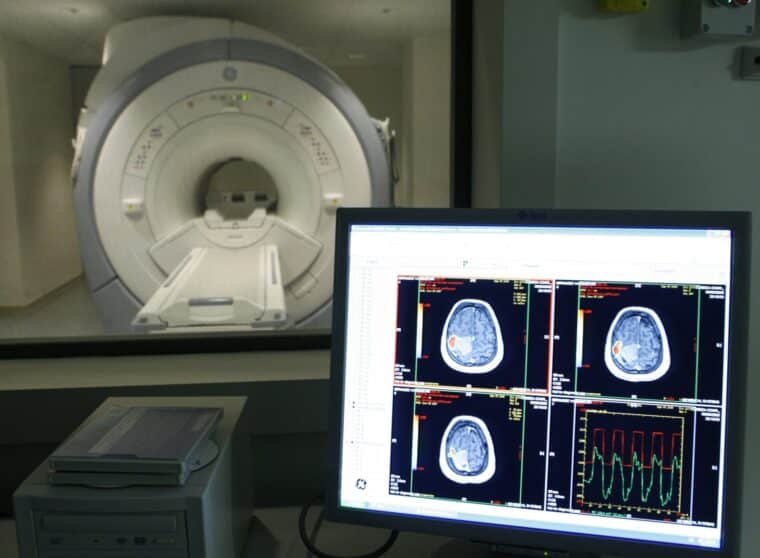 Desarrollan una inteligencia artificial para dar diagnósticos tempranos de demencia a pacientes latinoamericanos 