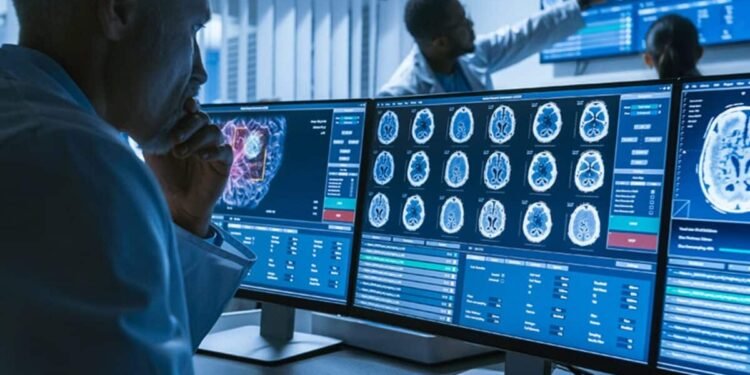 Crearon un sistema con IA para detectar las lesiones cerebrales que causan la epilepsia en niños