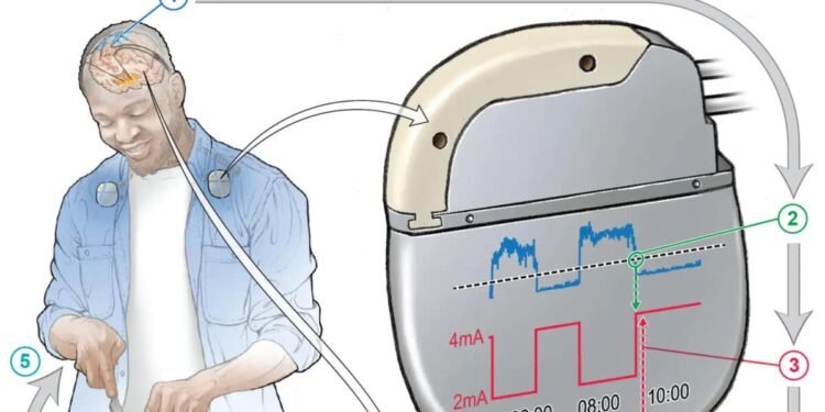¿Qué es el biohacking y qué riesgos representa en la seguridad digital actual?